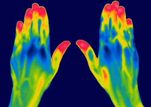 Using Thermal Camera On Hands